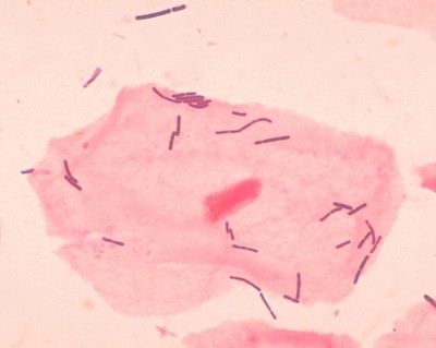 Лактобациллы